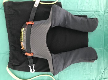 Hans carbono schroth